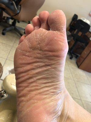 Feet AFTER pedicure.