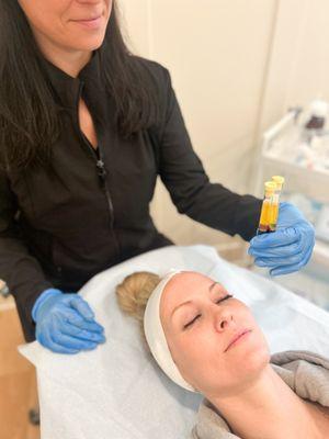 PRP with microneedling