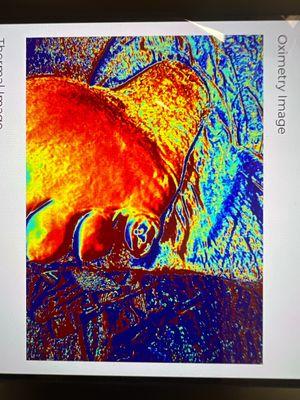 Near infrared spectroscopy to diagnose regional blood flow issues