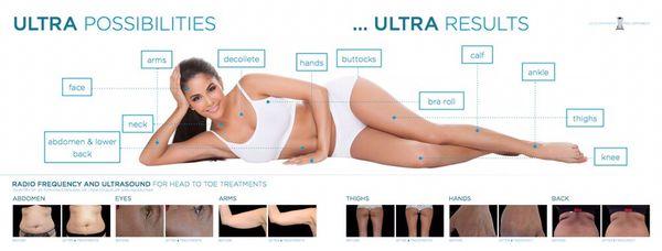 BTL Exilis. Skin Tightening Cellulite reduction fine lines and wrinkles. Nothing this machine can't do!