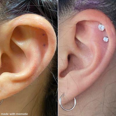 Double helix, on day 0 and day 2 after piercing.