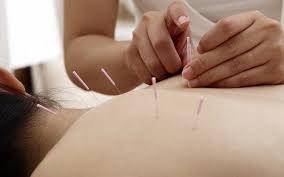 Traditional Eastern Acupuncture