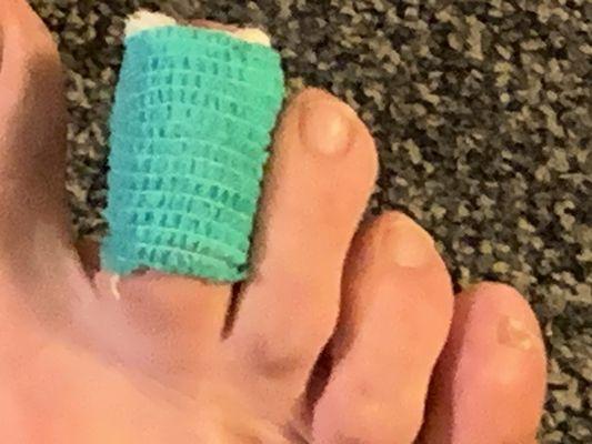 Dr. Rilling's neat bandage.  No pain in the 36 hours since he removed an ingrown toe nail.