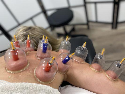 Cupping is one of many ways to loosen up the muscle tissue and fascia