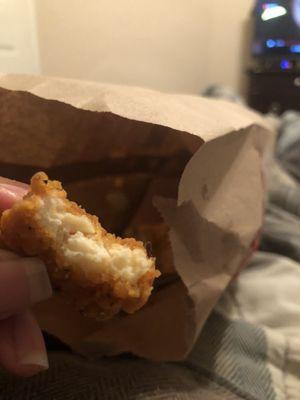 Hair in chicken nuggets