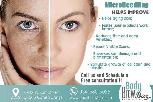 Microneedling