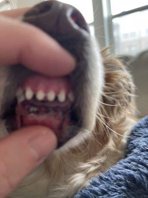 Where they pulled all of his healthy teeth from and replaced the holes with stitches.