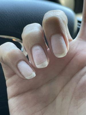 After photo of nails