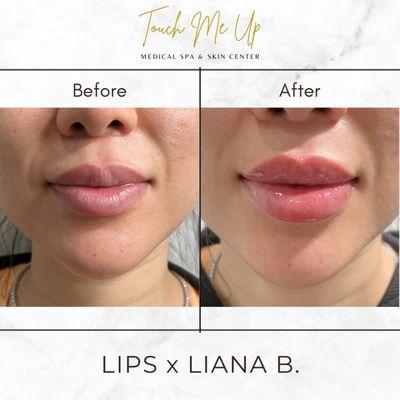 LIPS x LIANA B.