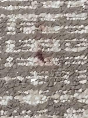 Blood stain in my carpet