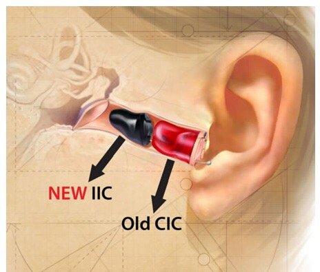 The invisible hearing aids, come for free consultation with free parking today !