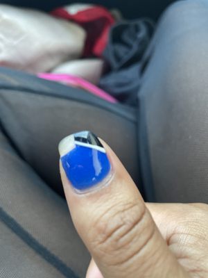 broken nail