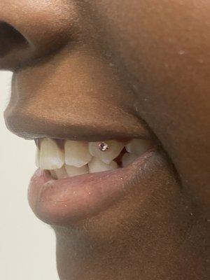 Would you like to put a little bling in your smile?  We love doing our tooth gems.