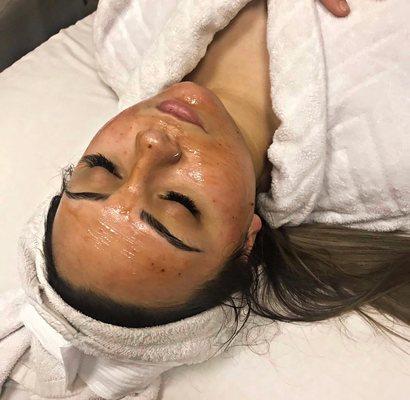 Arctic Cranberry Facial