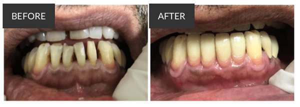 Restorative Dentistry