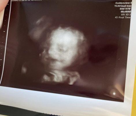 Goldenview Ultrasound 3d 4d HD Chicago