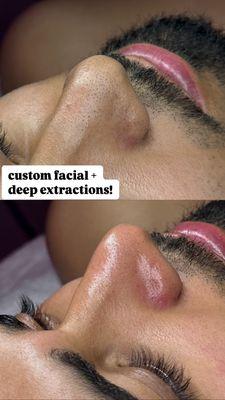 Custom Facials servicing all skin types! Catering to you skin needs!