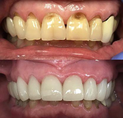 We offer complete dental restorations and smile design