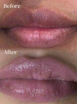 Lip Neutralization