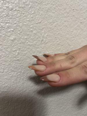 Lifted nails