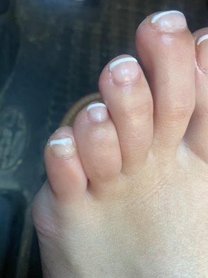 Pinky toe is completely awful.