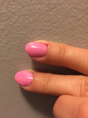 Injured nail cuticle and  smudged/grainy polish.