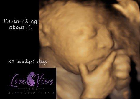 Love View 3d 4d ultrasound studio