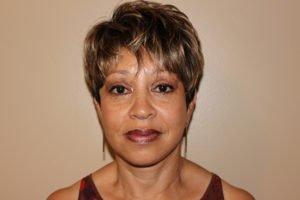 65 yo African American Female 1 month after facelift, browlift, and upper/lower blepharoplasty by Dr. Jeffords