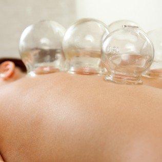 cupping therapy McKinney tx