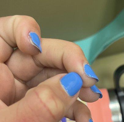 Damaged nails