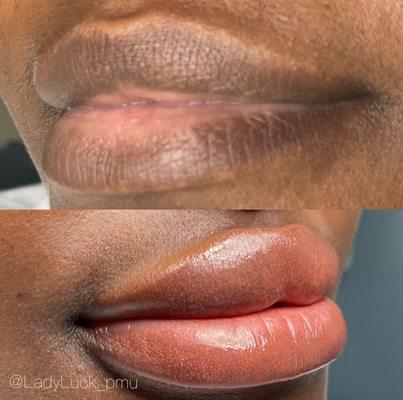 Lip neutralization before and right after