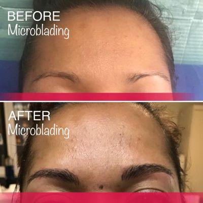 Microblading