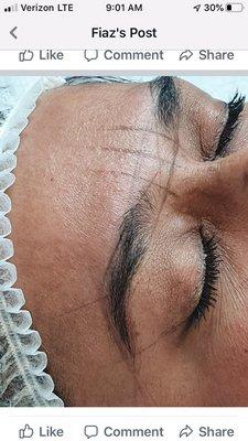 Brow map