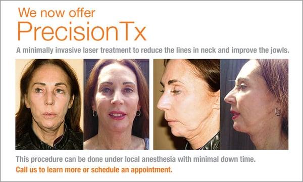 Smartlipo Precision Tx - Minimally invasive treatment to reduce the lines in neck and improve the jowls.