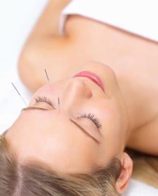 Anti-aging Acupuncture