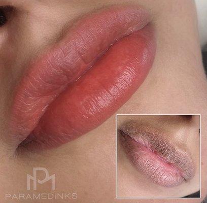 Lip neutralization