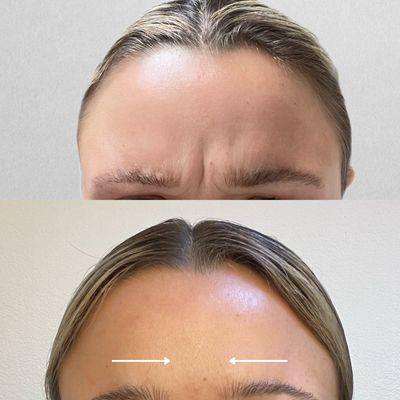 Laurie Peterson RN CANS | Aluma Medical Aesthetics