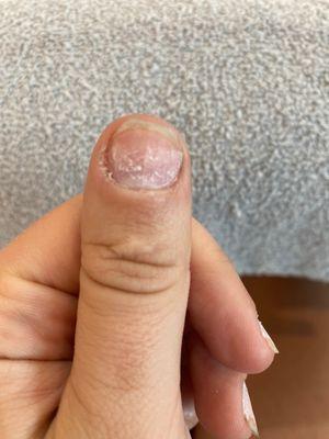 Better image of the glue and acrylic not being attached to my nail