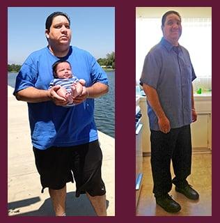 Visit our Before & After Gallery: http://www.dietdoctors.net/before_after_gallery.html