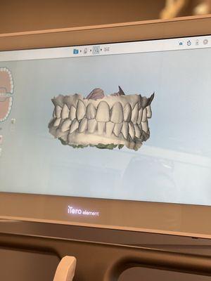 My teeth scan!