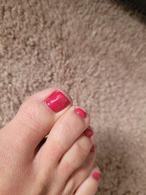 Sloppy pedicure. The polish on the big toe is lumpy and dented