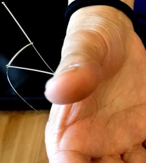 New Acupuncture Techniques to relieve Pains