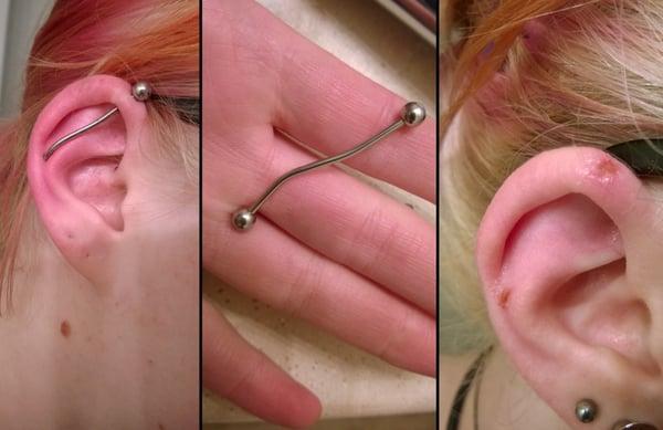 If they refunded every piercing they screwed up, they'd be bankrupt.