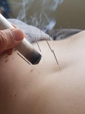 Moxibustion for back spasms