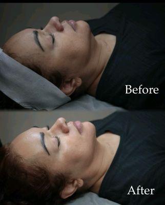 Anti-Aging Facial