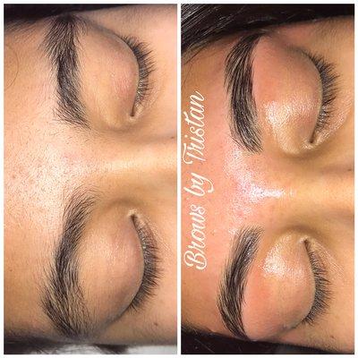 Brow shaping