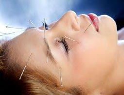 Cosmetic Acupuncture & Wellness