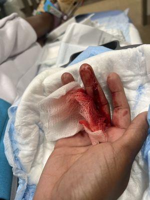 My cut finger