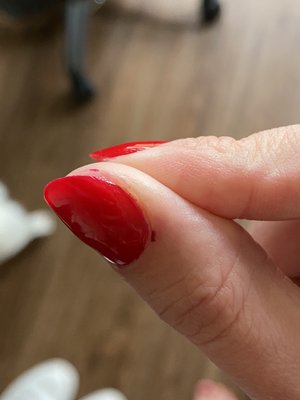 Cut cuticle and polish on skin