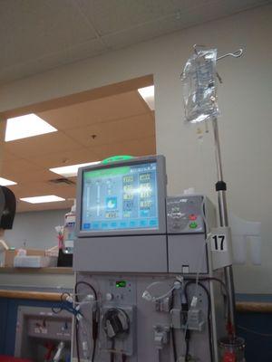 This is what a dialysis machine looks like when it's running